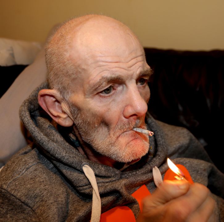 Paul Park 59, who deliberately stubbed out a cigarette on a nurse's finger said hes not able to serve the three-month jail sentence handed down by a judge because of his broken back.
