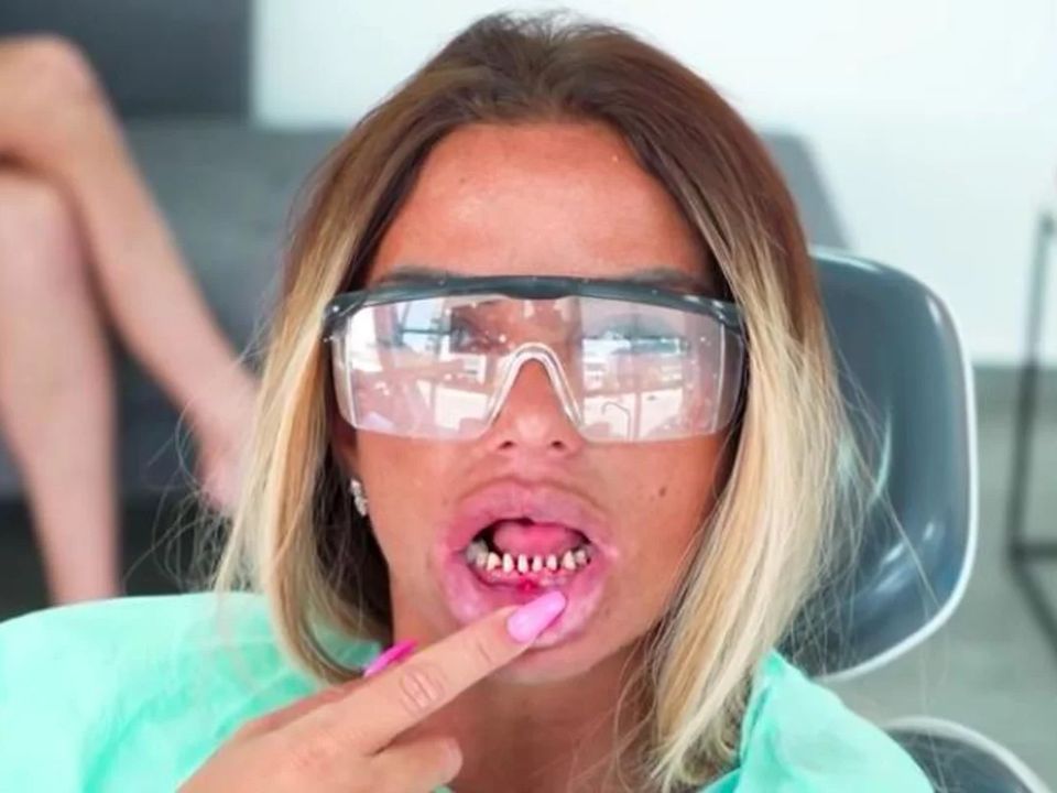 Katie Price’s teeth filed right down