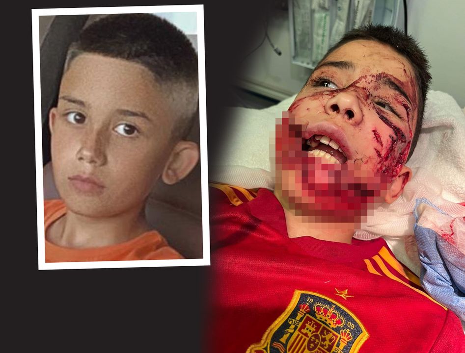 Horrific injuries suffered by Alejandro