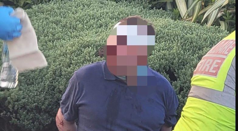 One of the injured burglary suspects