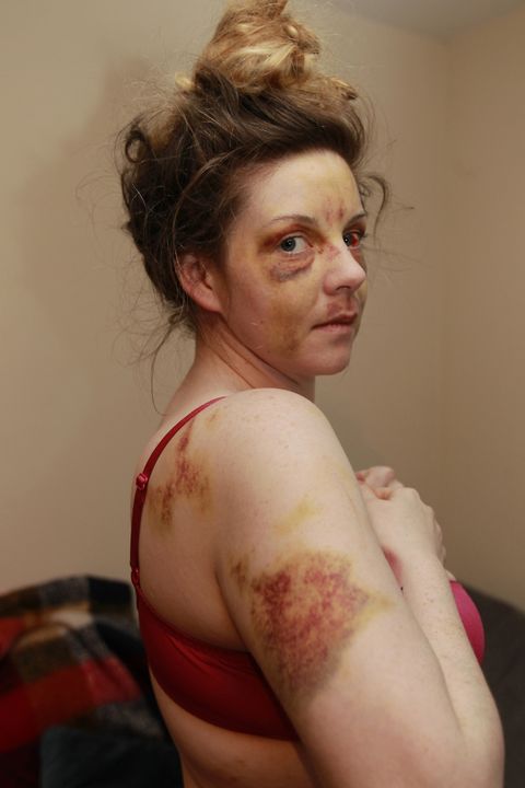 Louise Gilmore made headlines across the world when she posted a video of her injuries online just after the attack in November 2019.
The then 30-year-old mum-of-three suffered a broken nose, shattered cheekbone, a fractured skull and had 12 teeth knocked out saying she believed she was “going to die”. 
