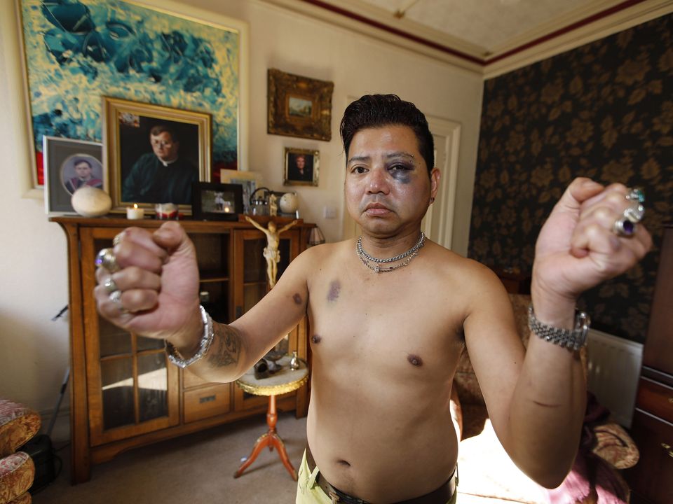 Eduardo Yanga, the former husband of Pat Buckley, was caught in a bar fight this week with left with a black eye and bruising to his body.