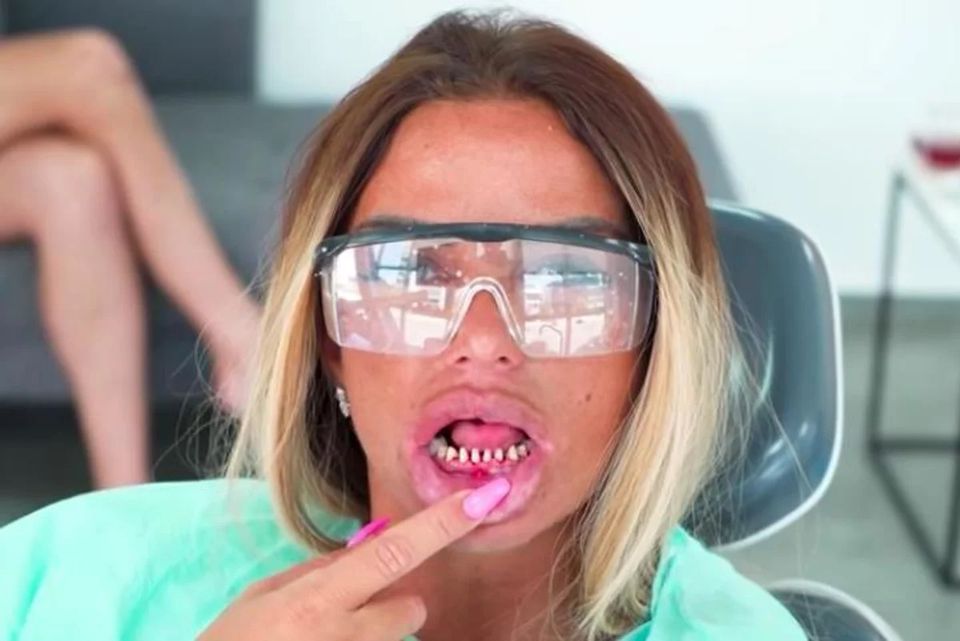 Katie Price’s teeth filed right down
