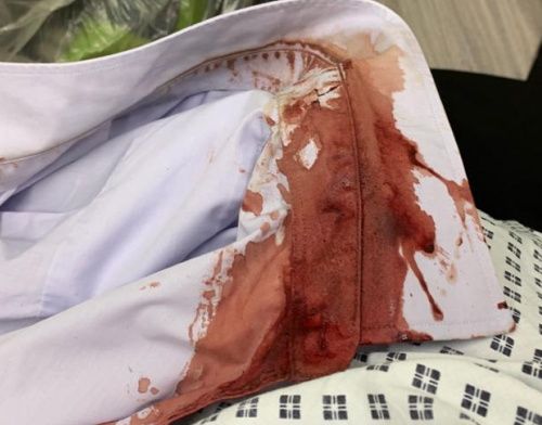 Blood is seen on Nial's clothes after the attack.