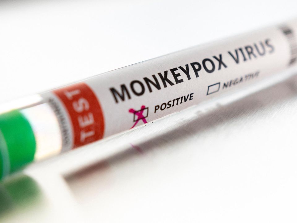 No case of monkeypox has yet been reported in the Republic
