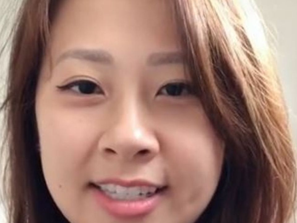 Brisbane native Angie Yen (28) woke up with an Irish brogue eight days after undergoing tonsil surgery