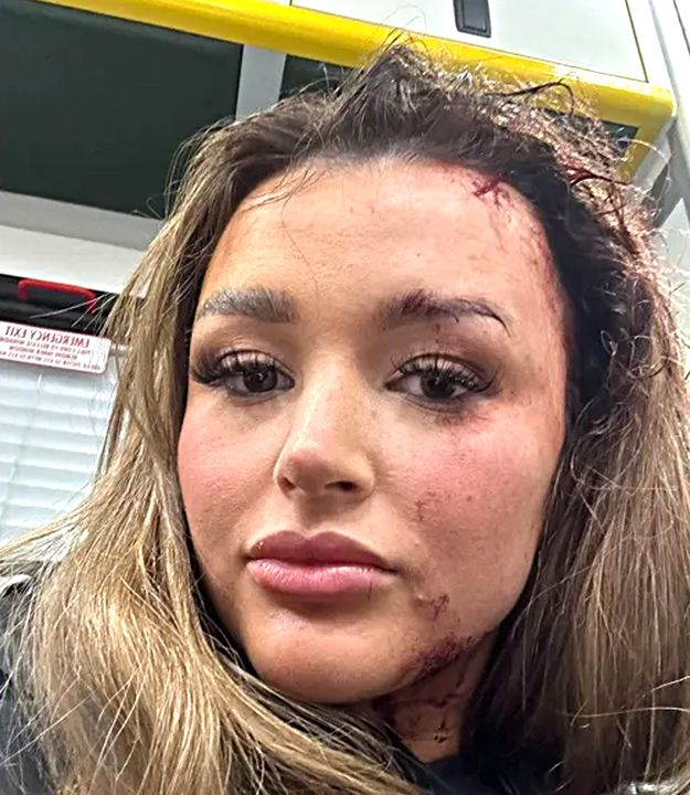 Influencer Charleen was taken to hospital for her injuries