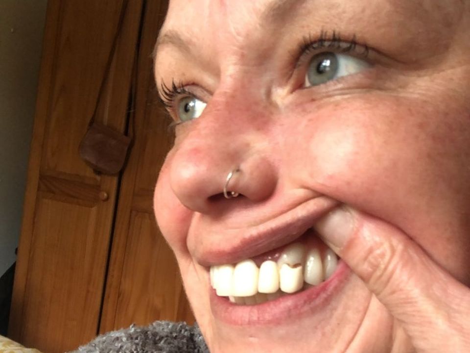 Majella’s crowns fell out 15 months after she had the work done in Kusadasi
