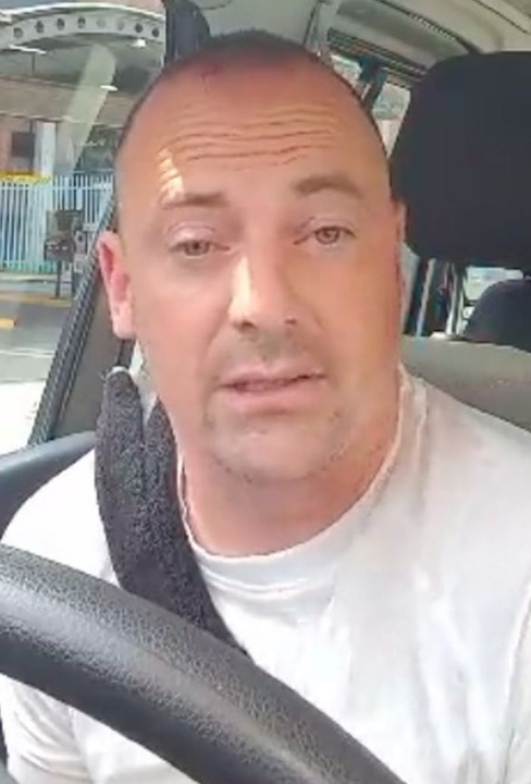 Pepper said he didn’t travel to Turkey specifically for the hair transplants