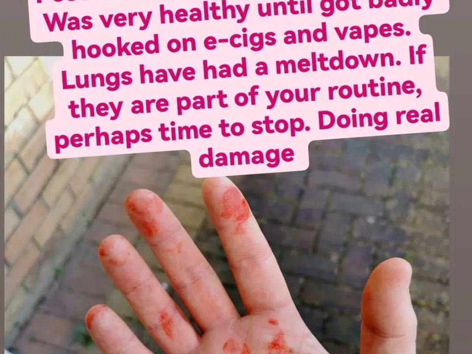 Ex RTE star Eoghan McDermott issues warning about vaping after