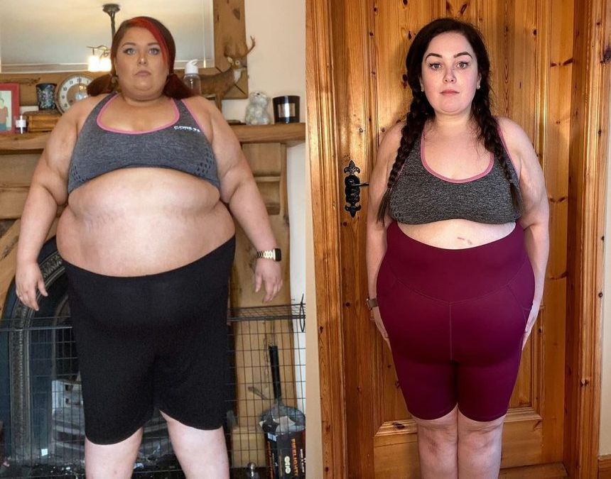 Joanne’s body transformed following her bariatric surgery and the loss of eight stone
