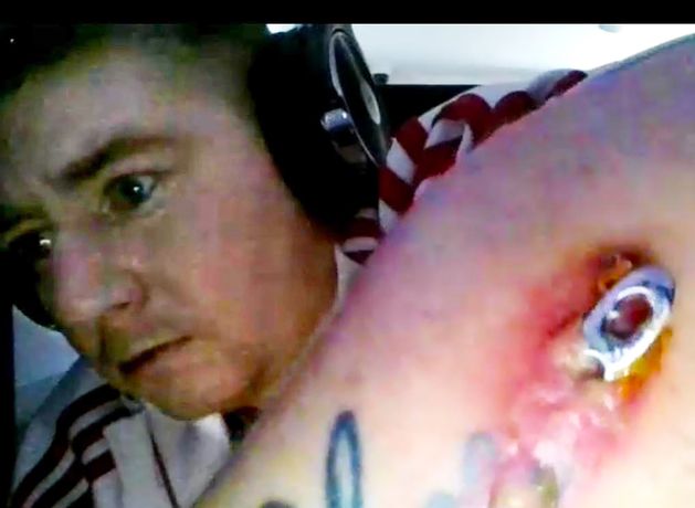 These are the shocking images of a father who had his arm smashed by paramilitary thugs but now says he’s been denied medical attention in Maghaberry Prison.