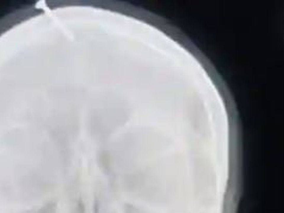 The x-ray of the woman's head went viral