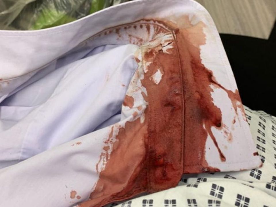 Blood is seen on Nial's clothes after the attack.