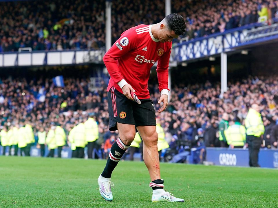 Manchester United's Cristiano Ronaldo assesses the cuts on his leg after the final whistle