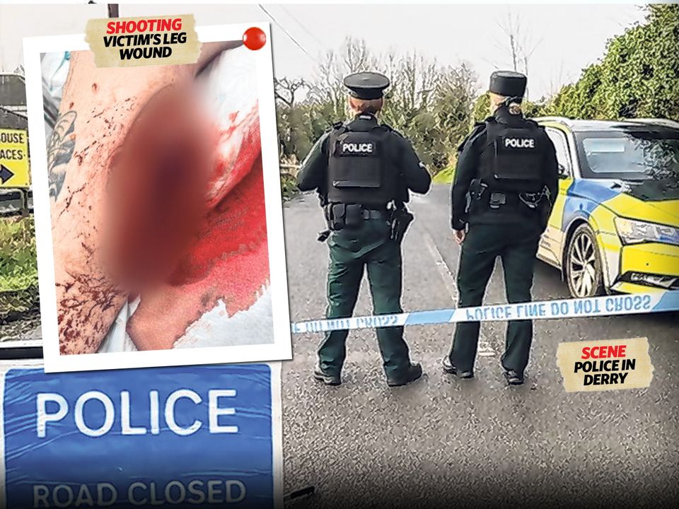 Horrific gun shot wound suffered by Co Derry man