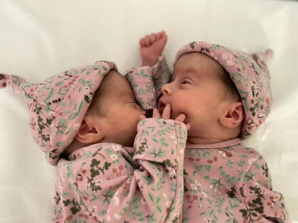 Isabelle and 2025 isadora conjoined twins