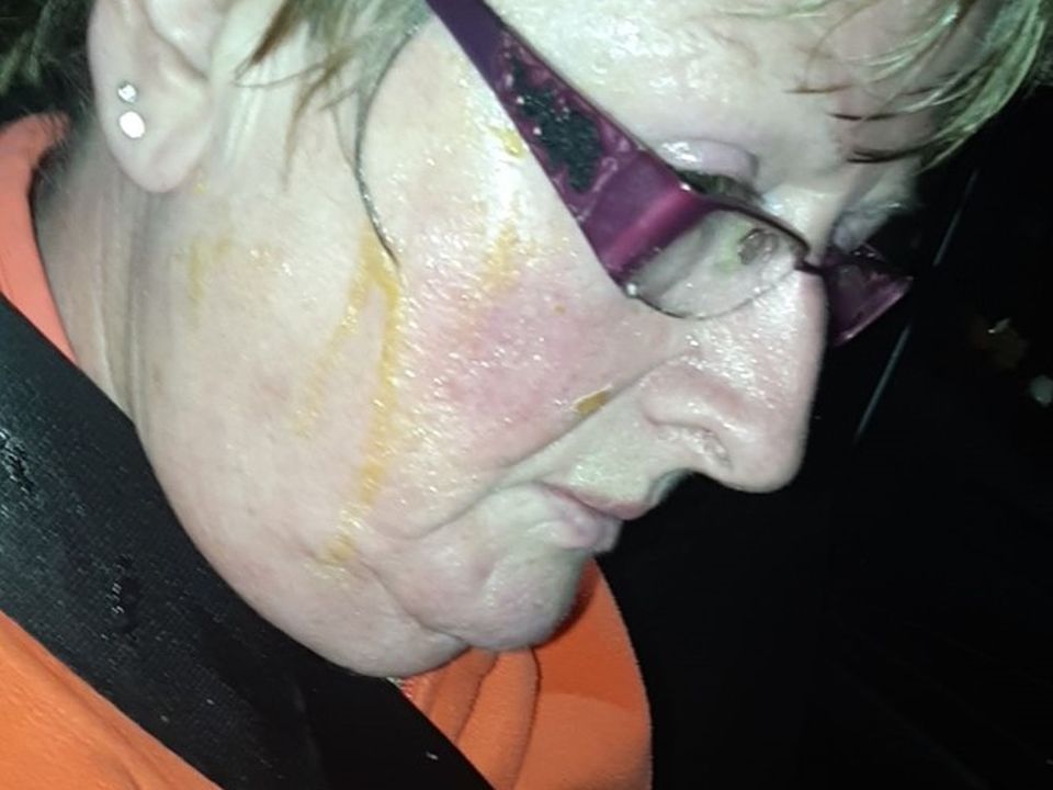 Mary Fahey sitting stunned in the egg-drenched interior of her Ford Kuga
