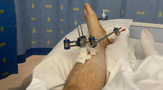 Mr Somers posted an update on his treatment