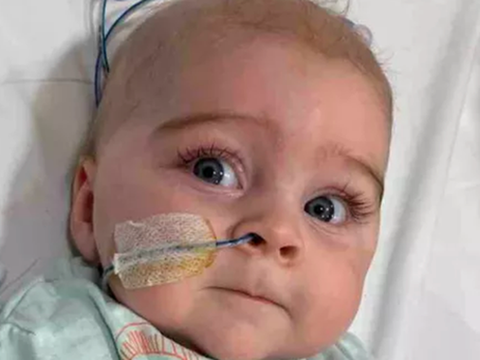 Six-month-old Luke Miles has a rare heart condition