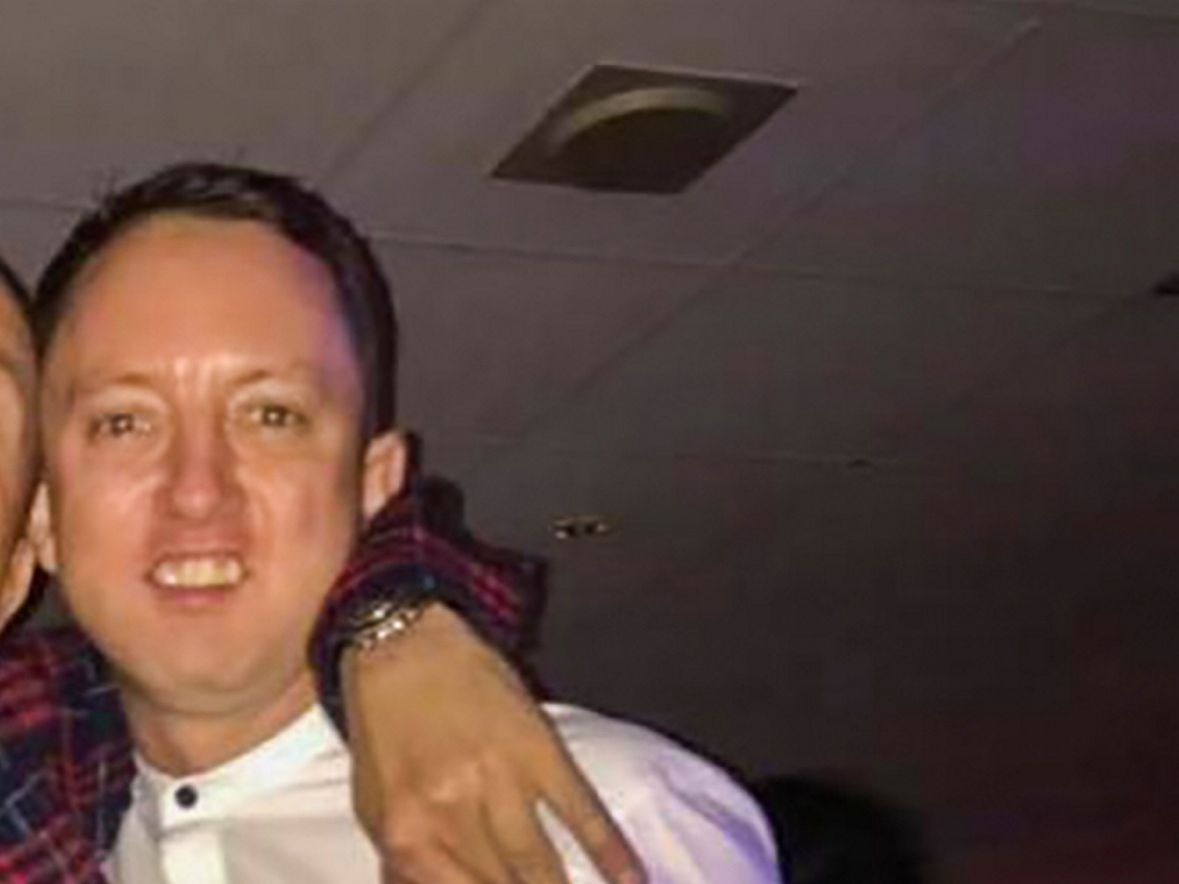 David Matthews : un fan de Belfast dépense de l’argent en greffes de cheveux, de dents de dinde et de visage